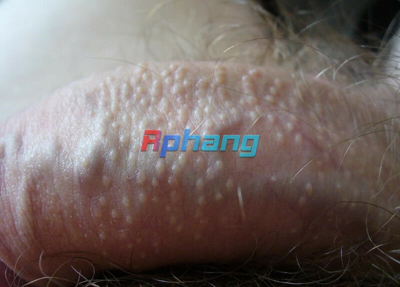 mun-duong-vat-8.jpg