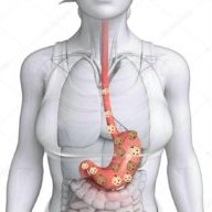 Máy đụt lỗ